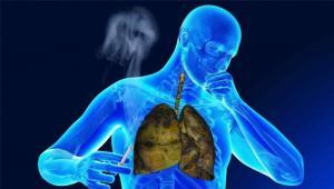 1694261243117-16642-sigara-akciger-hastaliklarinin-sebeplerinden-biridir-300-x-170.jpg