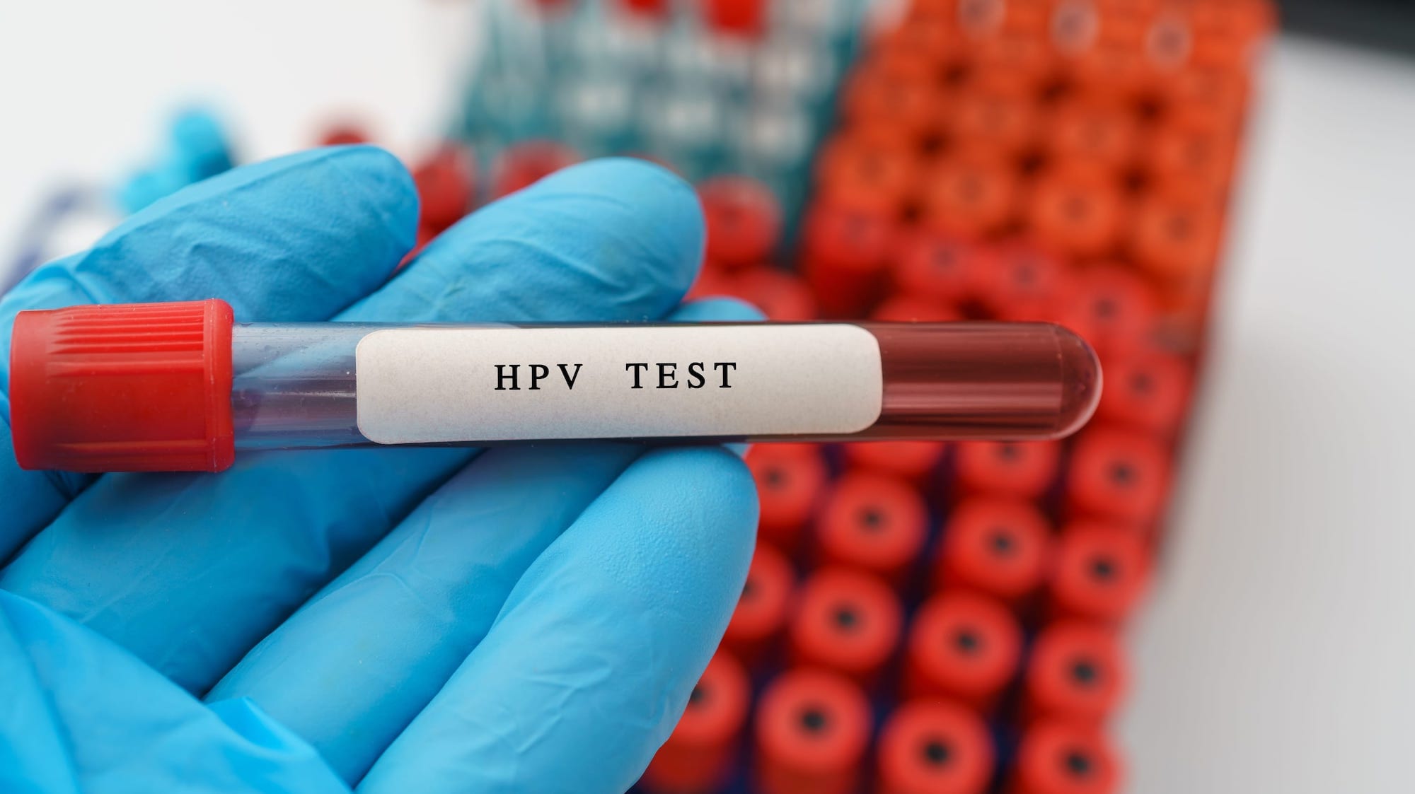 hpv-test.jpg