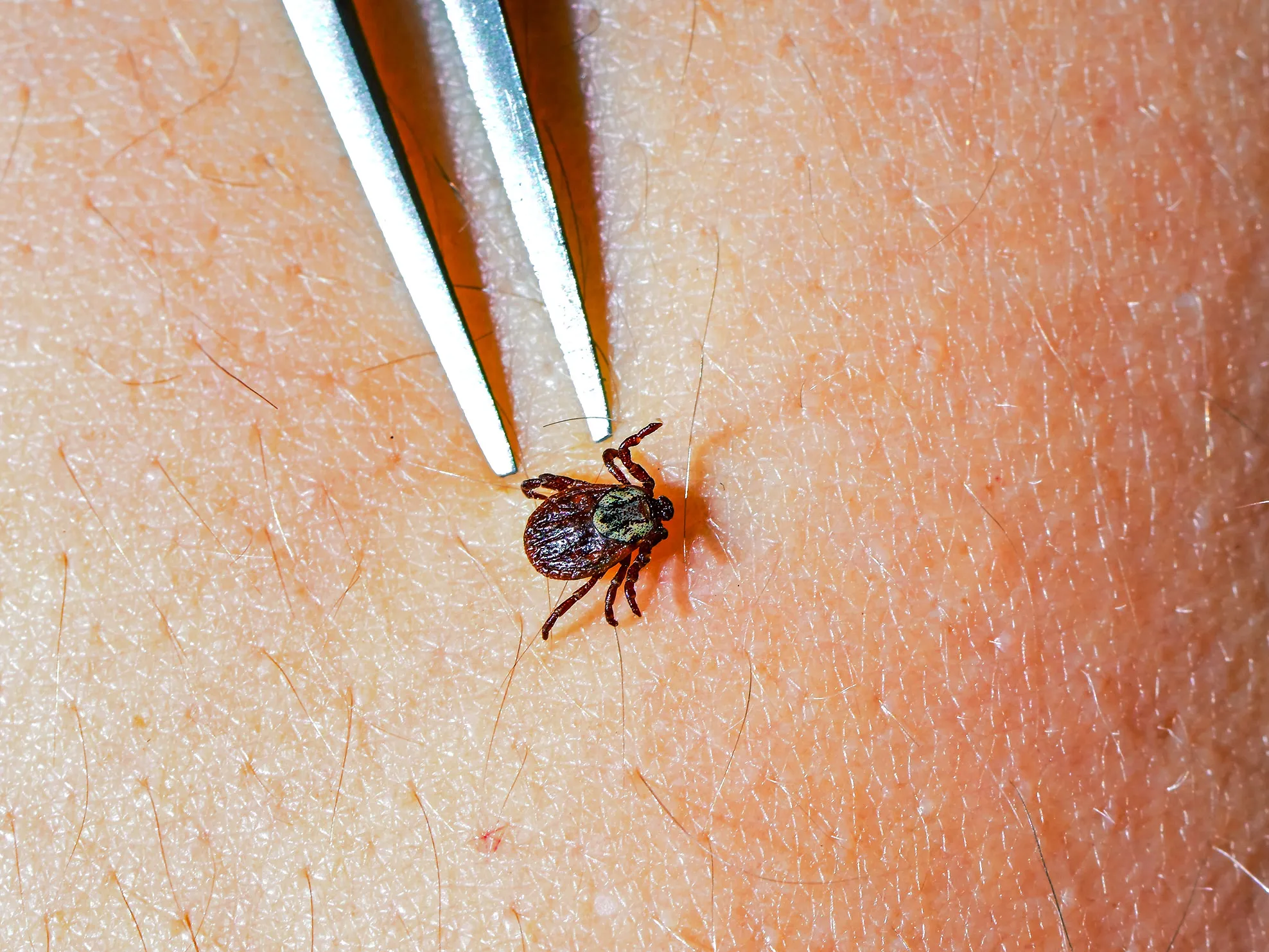 tick-lyme-disease-pill-science-1893316604.webp